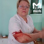 Девушка в Башкирии изрезала врача ручкой за то, что та приняла коллегу без очереди