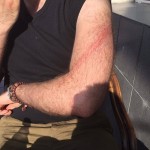 Журналиста «Комсомольской правды» избили нагайкой во время митинга в Москве